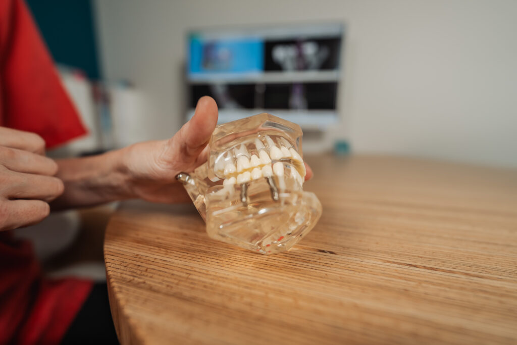 extraction dent sagesse complexe montferrier sur lez x Implants dentaires Eurêka dentaire - Chirurgiens-dentistes à Castelnau-le-Lez