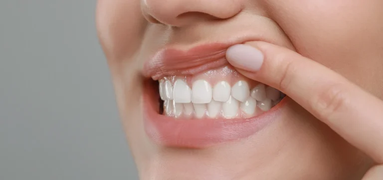soins gencives Soins des gencives Eurêka dentaire - Chirurgiens-dentistes à Castelnau-le-Lez