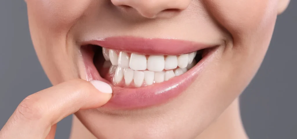 soins gencives detartrage Urgences dentaires Eurêka dentaire - Chirurgiens-dentistes à Castelnau-le-Lez