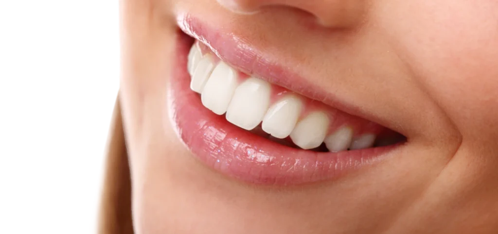 traitement esthetique dentaire Soins esthétiques Eurêka dentaire - Chirurgiens-dentistes à Castelnau-le-Lez