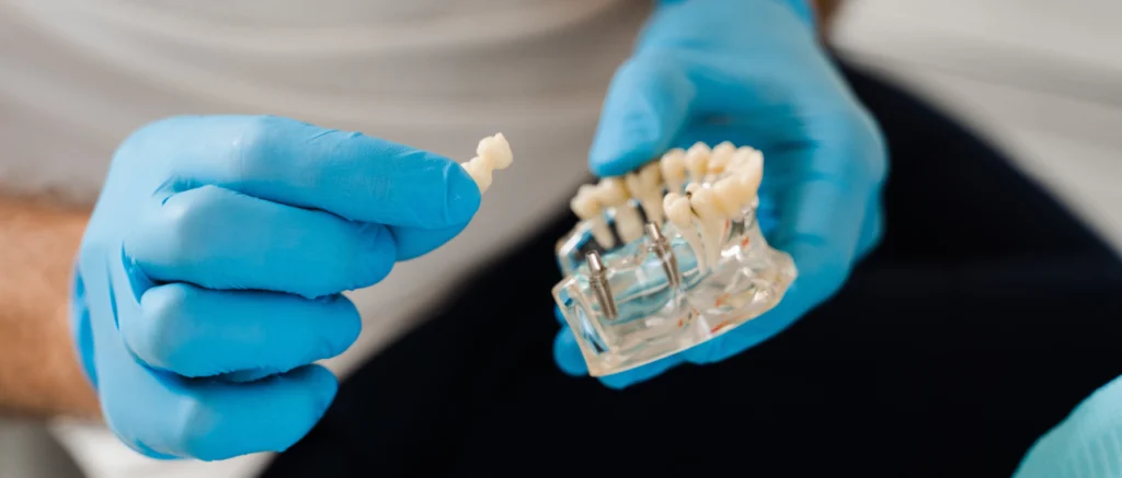 implant dentaire cres castelnau le lez Dentiste à Le Crès : implants dentaires Eurêka dentaire - Chirurgiens-dentistes à Castelnau-le-Lez