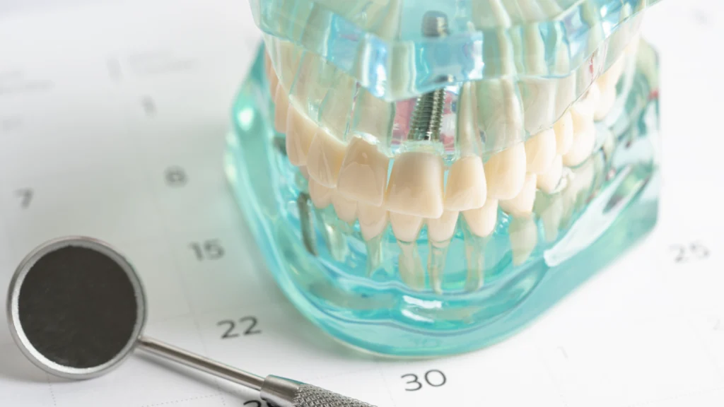 implant dentaire montferrier sur lez Dentiste à Montferrier-sur-Lez : implants dentaires Eurêka dentaire - Chirurgiens-dentistes à Castelnau-le-Lez